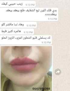 مايكربلاديغ توريد شفايه